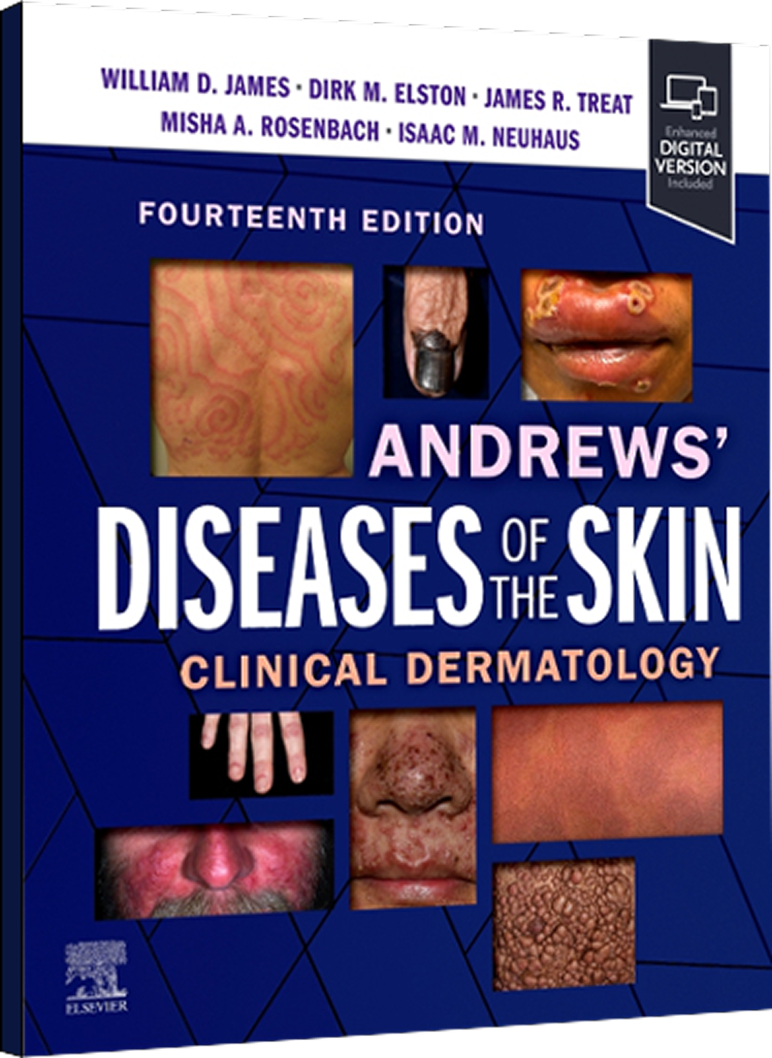 Andrews' Diseases of the Skin, 14th Edition